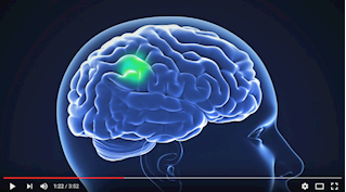 Tumor Paint - Pediatric Brain Cancer