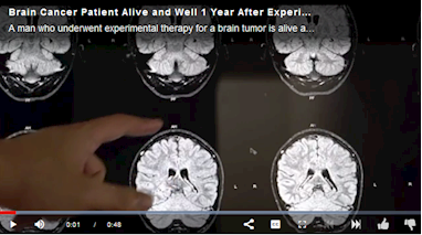 Gateway Funded Immunotherapy Trial Shows Promise for Treating Aggressive Brain Cancer